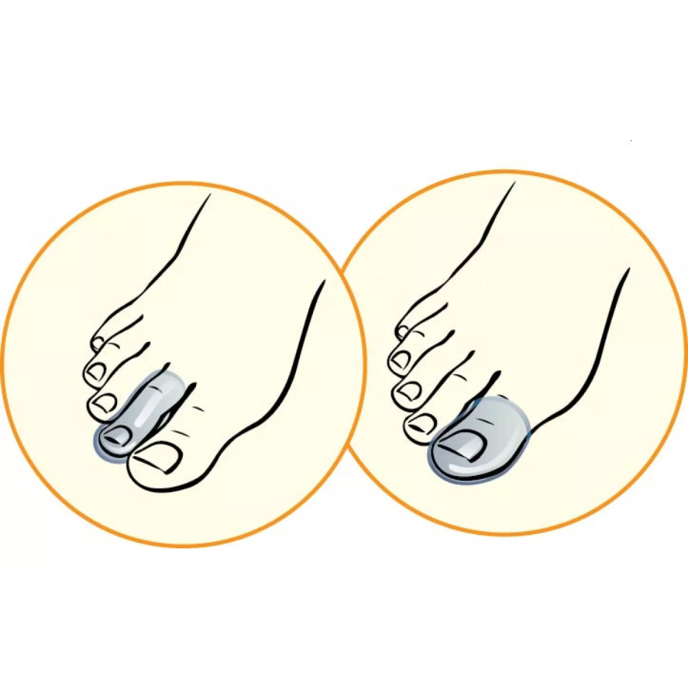 ПРОТЕКТОР TALUS ДЛЯ ПАЛЬЦЕВ СТОПЫ 04C
