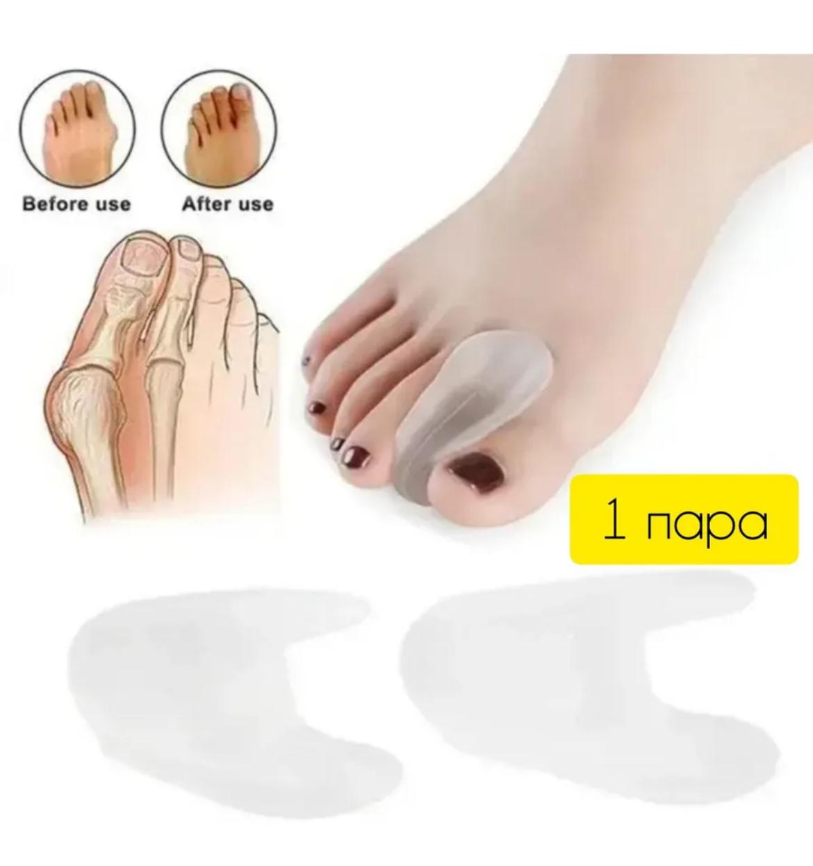 РАЗДЕЛИТЕЛЬ ОРТОПЕД-ШОП СИЛИКОН ФИКСИРУЮЩИЙ R.010(1шт)